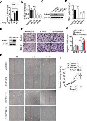 P-Rex1 Cooperates With TGFβR2 to Drive Lung Fibroblast Migration in Pulmonary Fibrosis